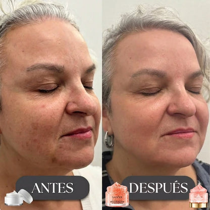 Placenta Pro Crema Antiedad Pack 2x1 — Su piel joven hoy🔥