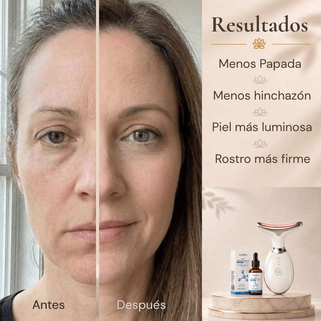 V-Face Ultra Masajeador de Terapia Fotónica — Elimina la papada y arrugas sin cirugías✅