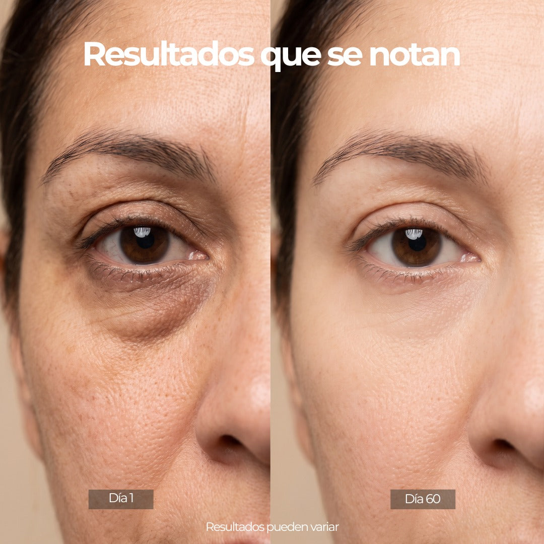 LuxLift™ Máscara de led · Firmeza y luminosidad. Rejuvenecimiento y Cuidado de la Piel✨