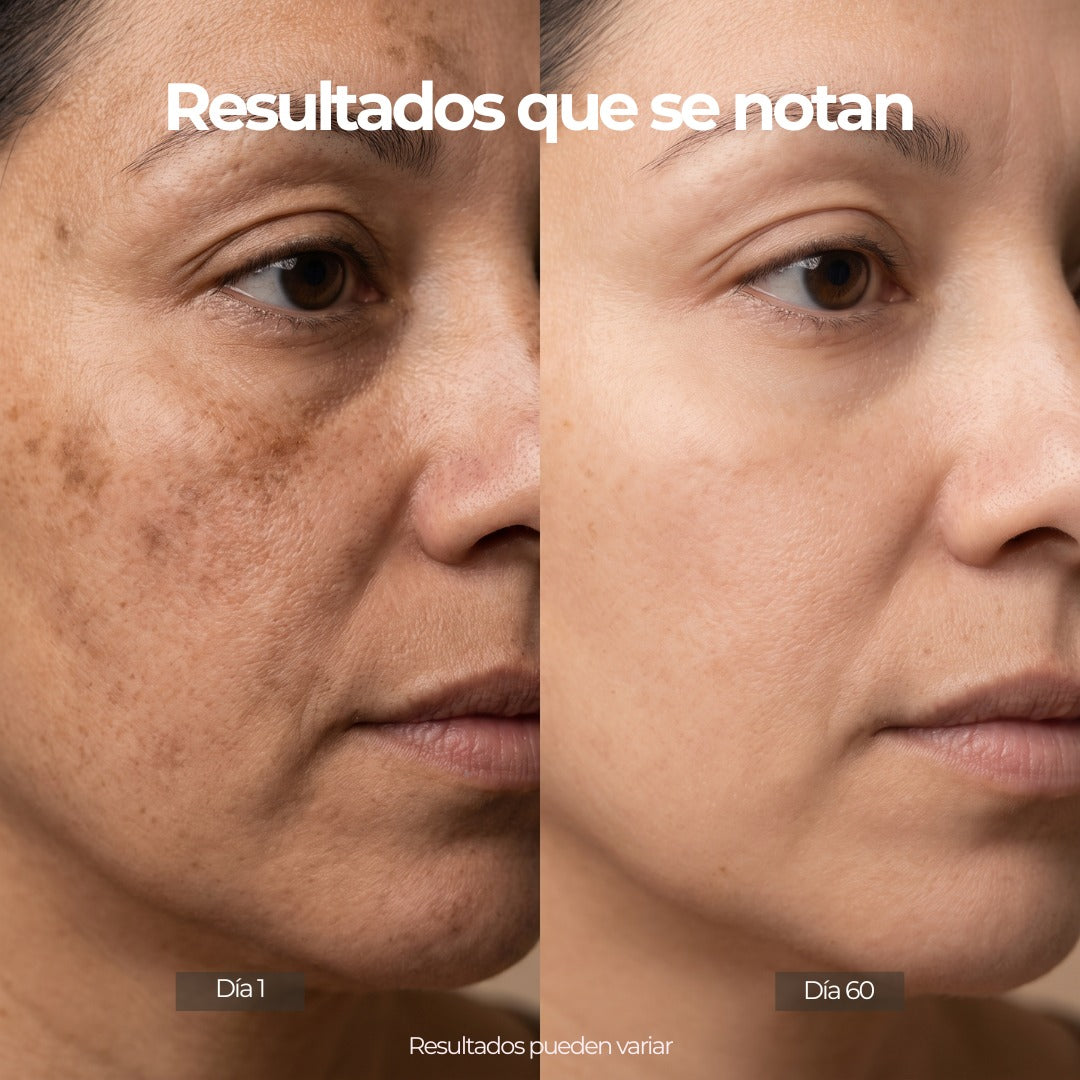 LuxLift™ Máscara de led · Firmeza y luminosidad. Rejuvenecimiento y Cuidado de la Piel✨